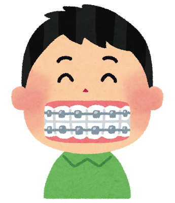 【体験記⑯　～DAY260】調整１２、１３回目　歯の隙間がくっつきました